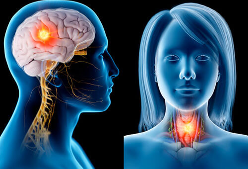 Head & Neck Cancer