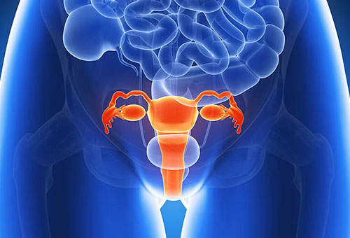Gynecologic Cancer