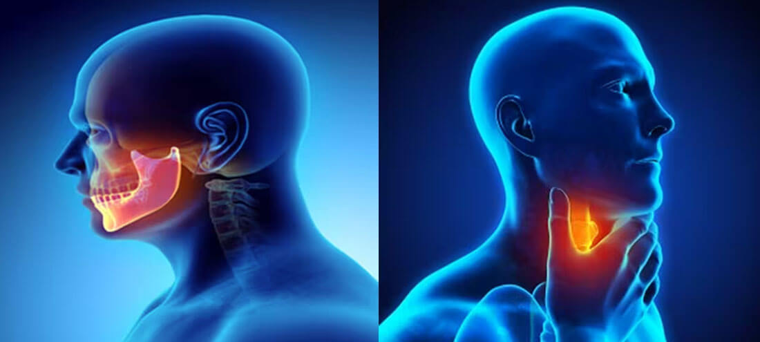 Head Neck Cancer